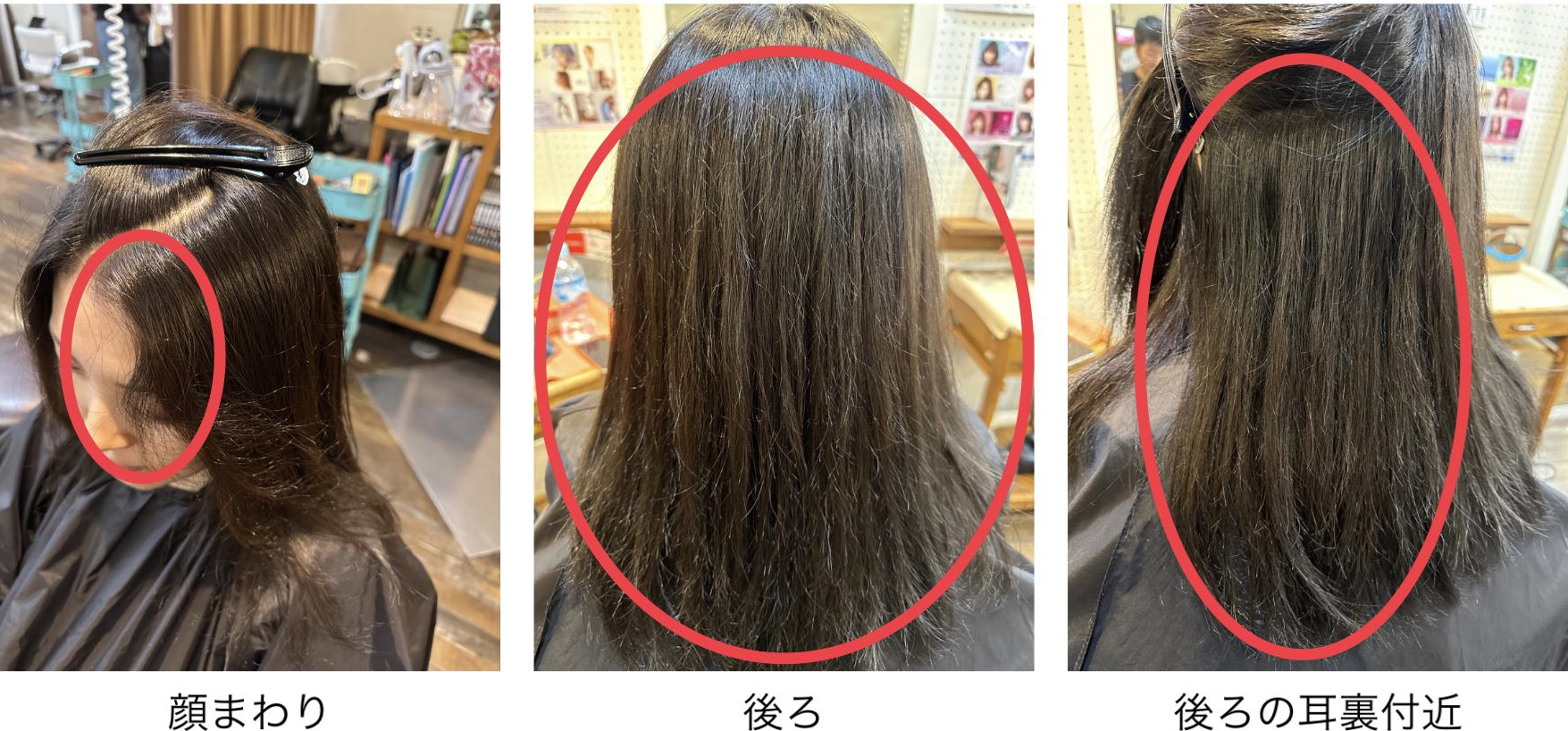 くせの種類